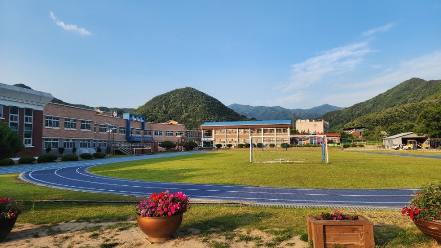 몽고반점 사진 5