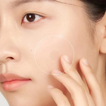  모낭염과 여드름 차이, 피부과 가기 전 꼭 구분해야 하는 이유