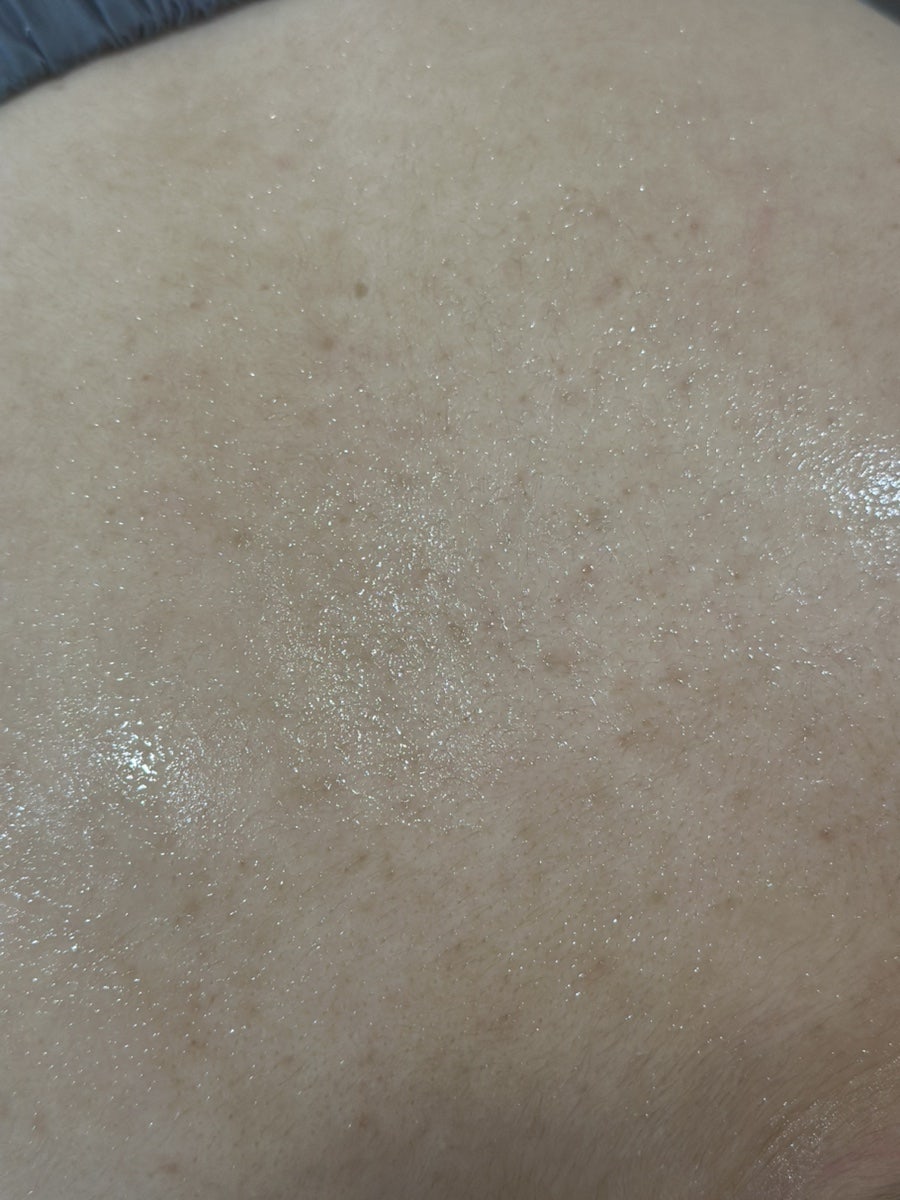 바르다피부 사진 6