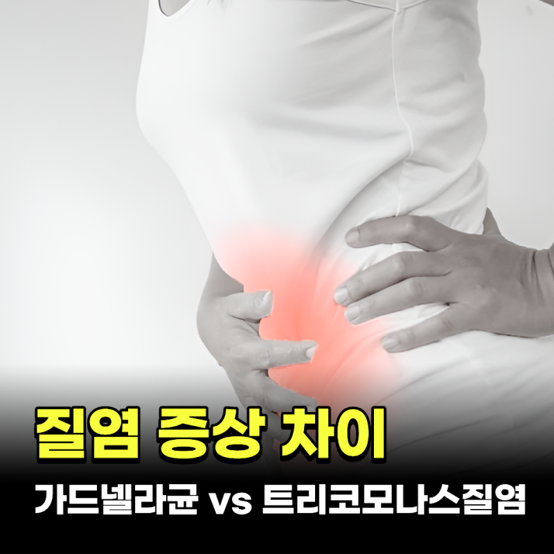가드넬라균 vs 트리코모나스질염 증상 차이와 예방법