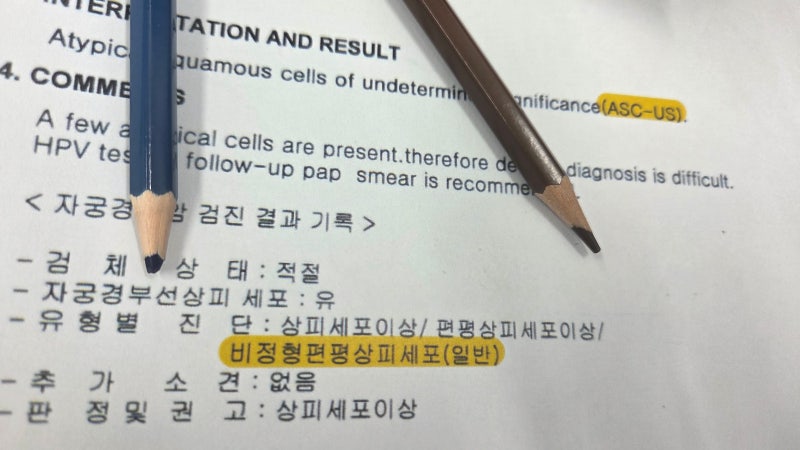 비정형편평상피세포 이상 어떤 의미일까? 원인은