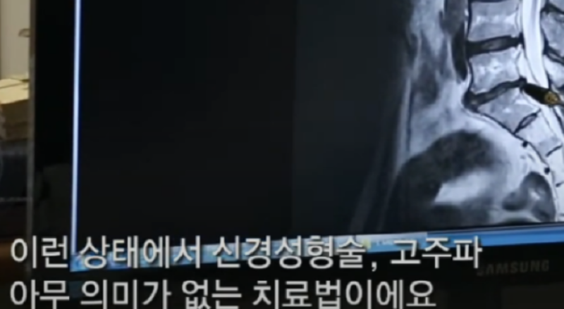 경추전만수면 하는법