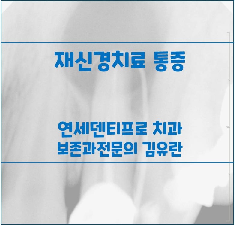 재신경치료 통증, 왜 생길까요? 원인을 알면 마음이 편해집니다.