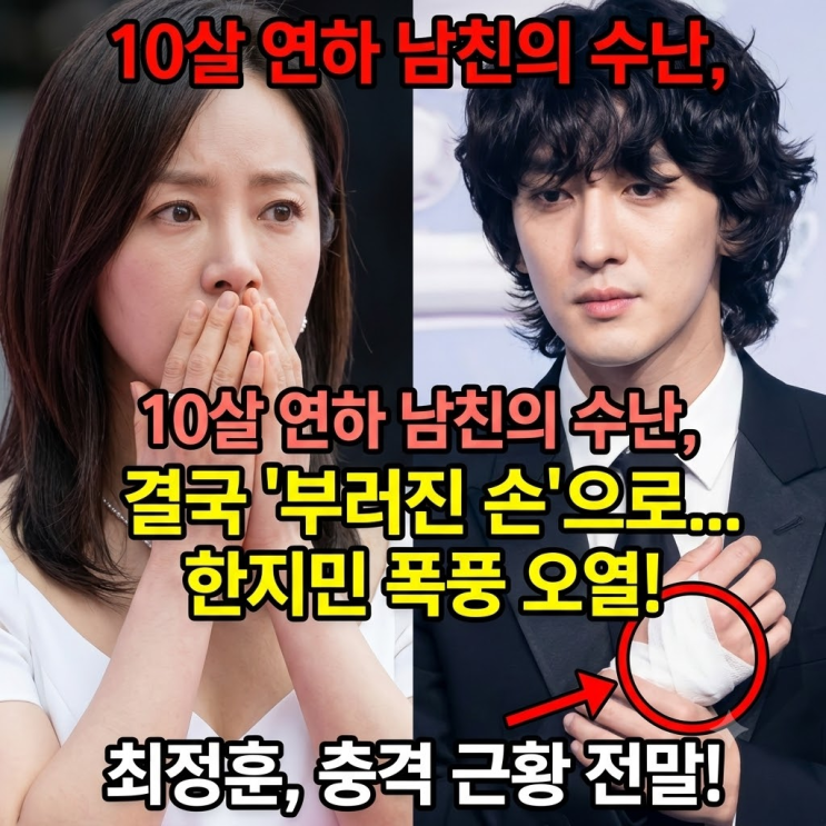  "대학 축제 도중 손 부러진 잔나비 최정훈", 2주 더 깁스해야 하는 충격적인 이유...