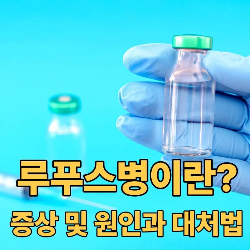 루푸스병 증상 원인 대처법...이유 없이 피곤하고 관절이 아프다면?