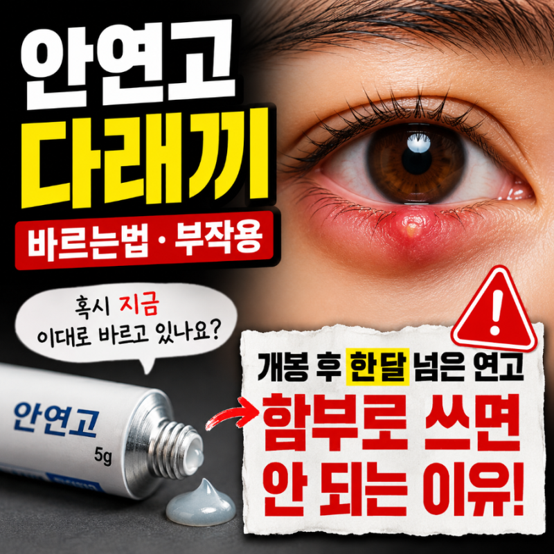 안연고 다래끼 (+바르는법, 부작용) - 개봉 후 한 달 넘은 연고 함부로 쓰면 안 되는 이유