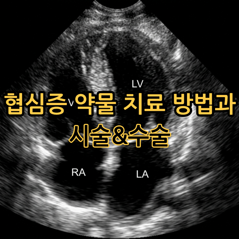 협심증 약물 치료 방법과 시술&수술