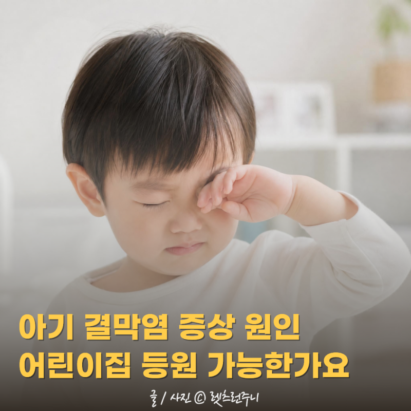 아기 결막염 증상 원인 어린이집등원 가능한가요