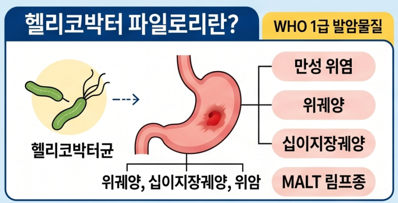 헬리코박터 검사, 요소호기검사(UBT)란?