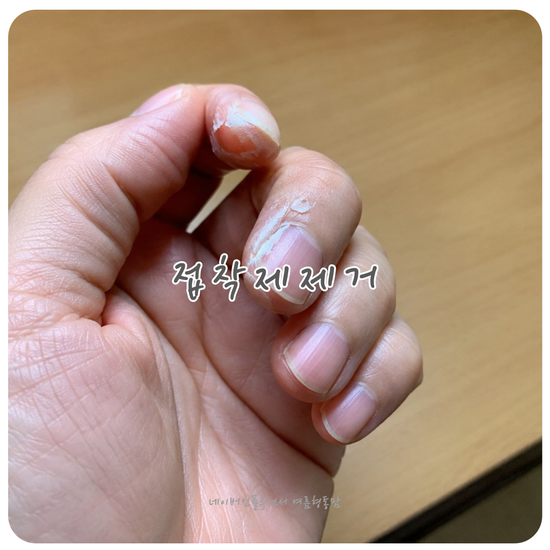 접착제 강력본드 제거 어떻게 할까? 소재별 순간접착제 지우는 법