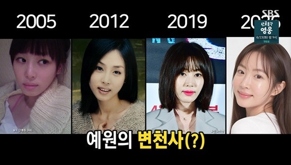 "이젠 누군지 모르겠다" 성형수술만 7번 중독 수준 강예원에...엄마도 탄식