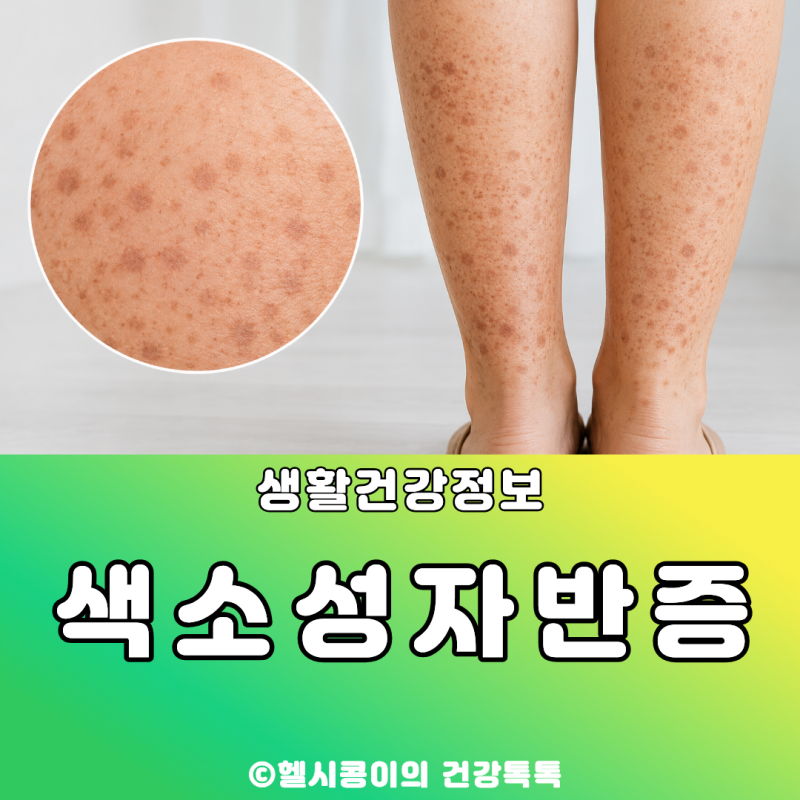 색소성 자반증 원인, 다리 자반증이 생기는 이유는 무엇일까?