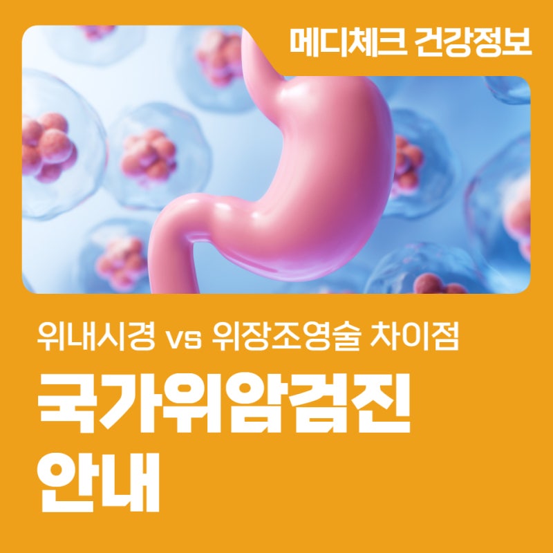 대전 위내시경 vs 위장조영술 차이점, 국가위암검진 안내