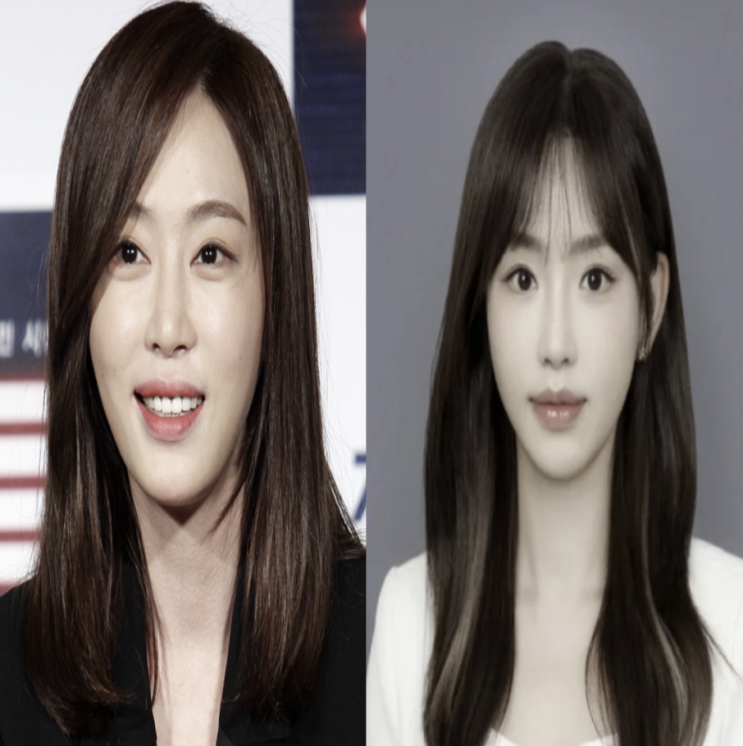아버지 사망 후 11억원 빚, 성형만 무려 7번" (<b>미운우리새끼</b>)
