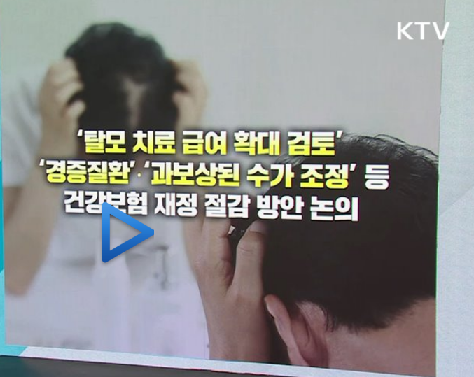  "미용 아닌 생존 문제.." 드디어 길 열린 청년 탈모 건보 적용 진짜 이유