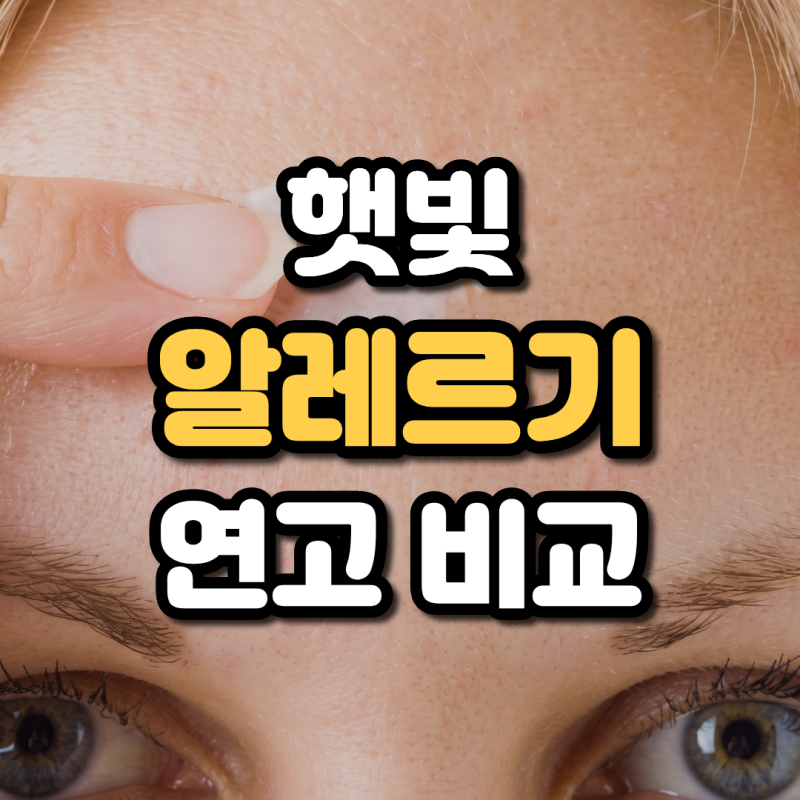 얼굴 햇빛알레르기 연고 약국 비판텐 리도맥스 가격 및 성분 비교 차이