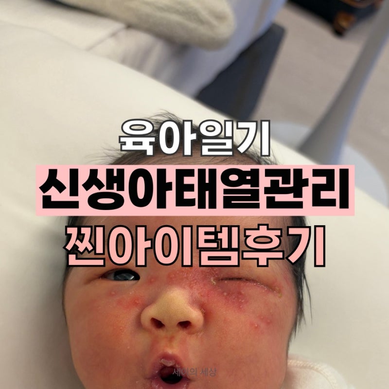 조리원에서 시작된 신생아 태열, 한 달 만에 좋아진 관리 방법(허긴 로션과 바를 수딩젤 사용....