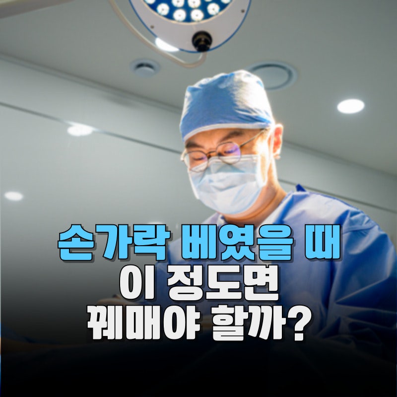 손가락 베였을 때 병원 어디로 가야 할까? 봉합이 필요한 기준까지