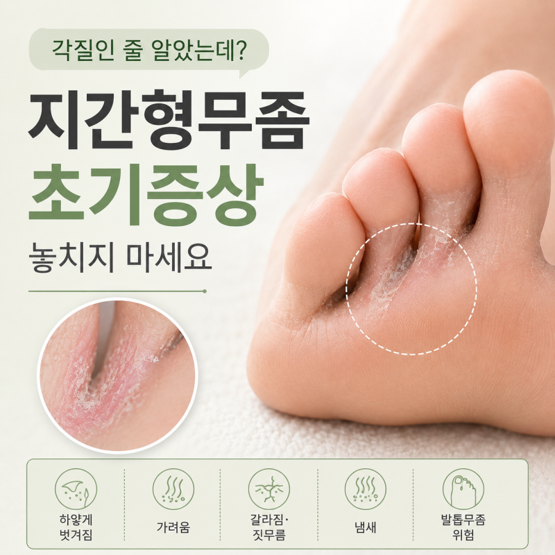 각질인 줄 알았는데? 지간형무좀 초기증상 놓치지 마세요