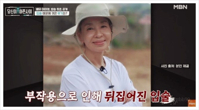  이미영 입술 부작용 고백, 공업용 물질 주입으로 배우 인생까지 흔들렸던 충격적 과거