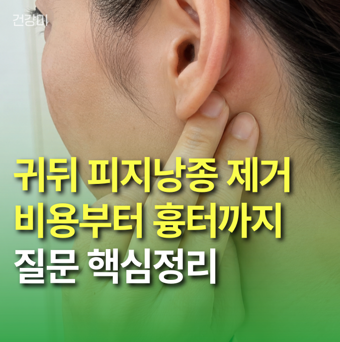 귀뒤 피지낭종 제거 비용부터 흉터까지, 실제 많이 묻는 질문 핵심정리