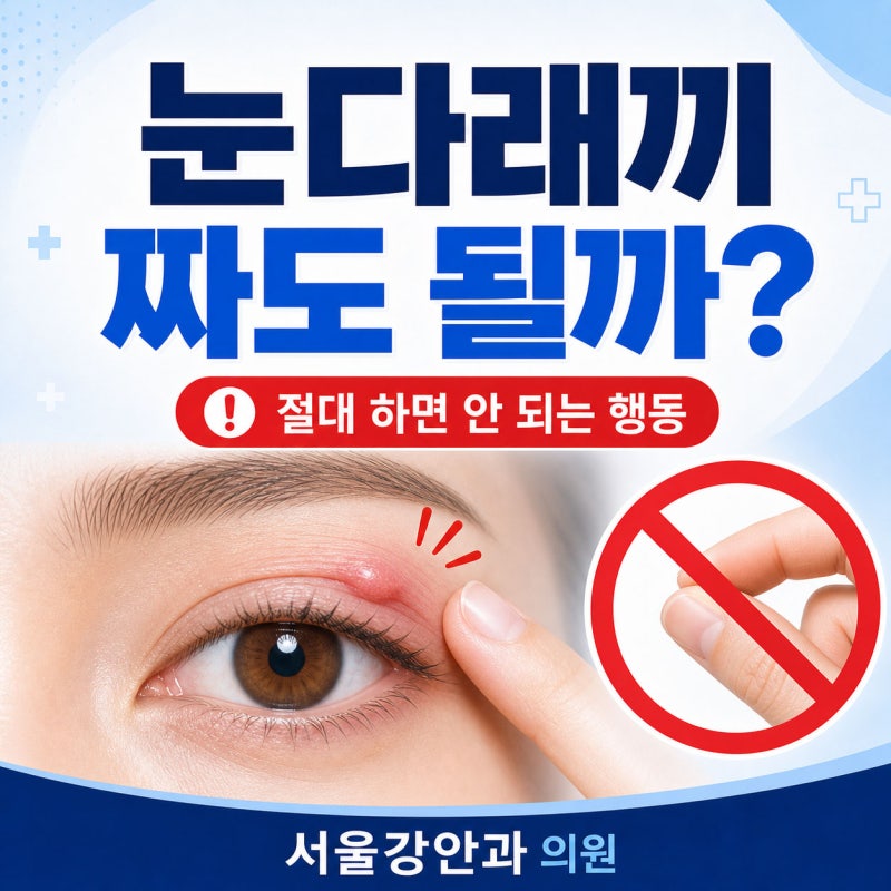 눈다래끼 짜도 될까? 빨리 낫고 싶을 때 절대 하면 안 되는 행동