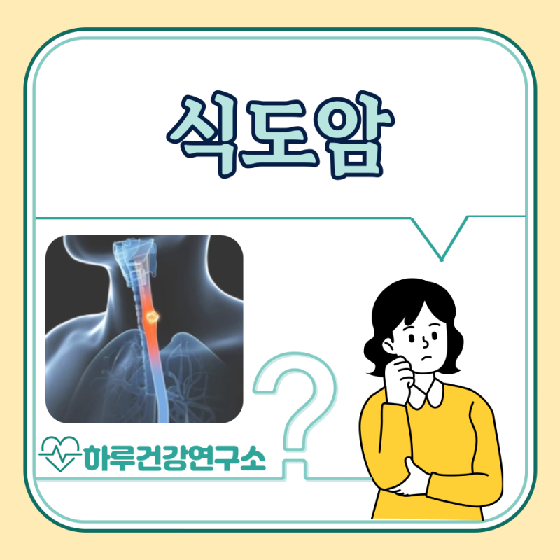 식도암 초기 증상, 원인, 치료 방법 : 1~4기 생존율