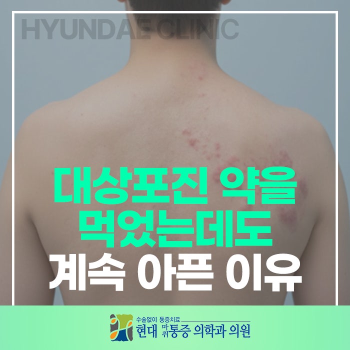 대상포진 약을 먹었는데도 계속 아픈 이유