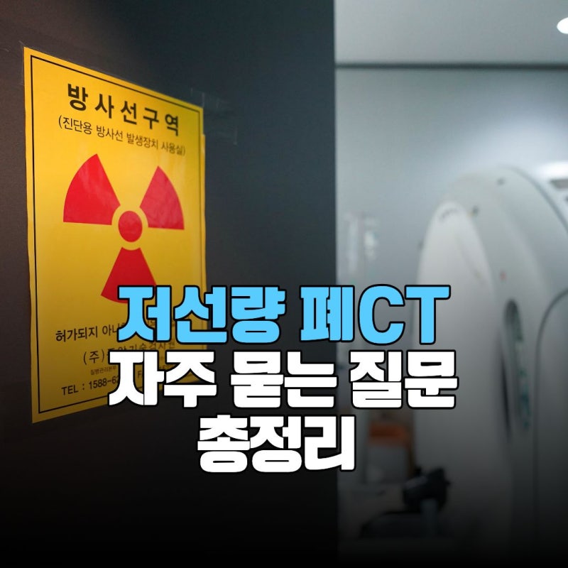 저선량 폐CT 누가 받아야 할까? 가격 방사선량 등 자주 묻는 질문