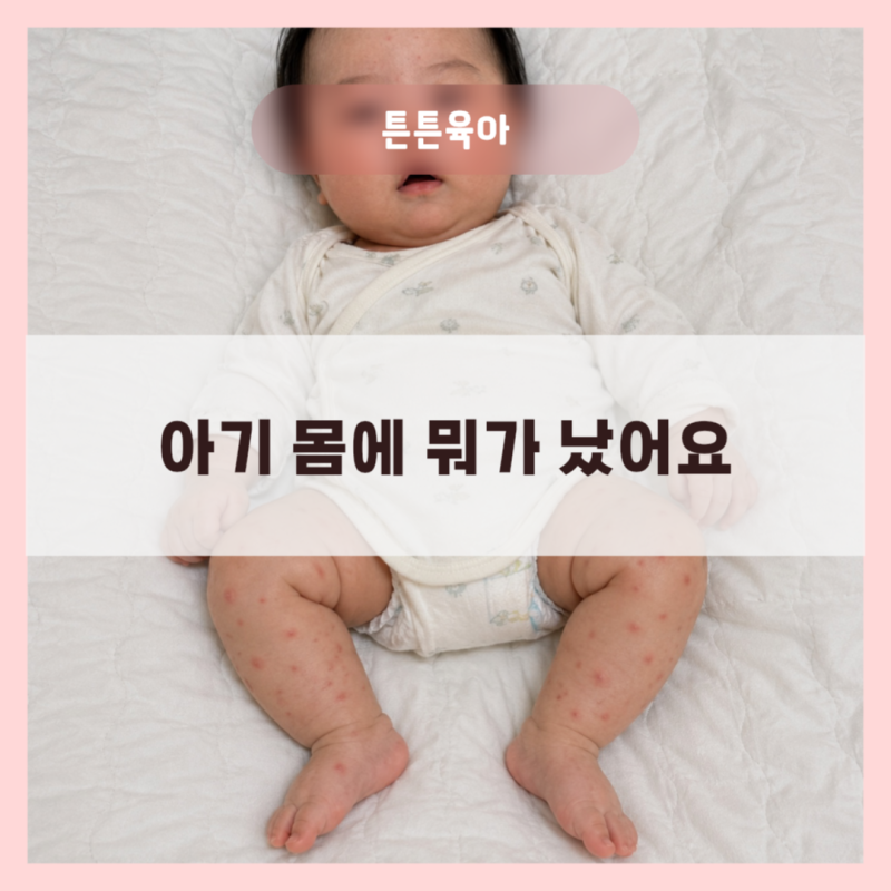 아기 다형홍반 증상 총정리｜발진 원인부터 경과, 관리 방법까지