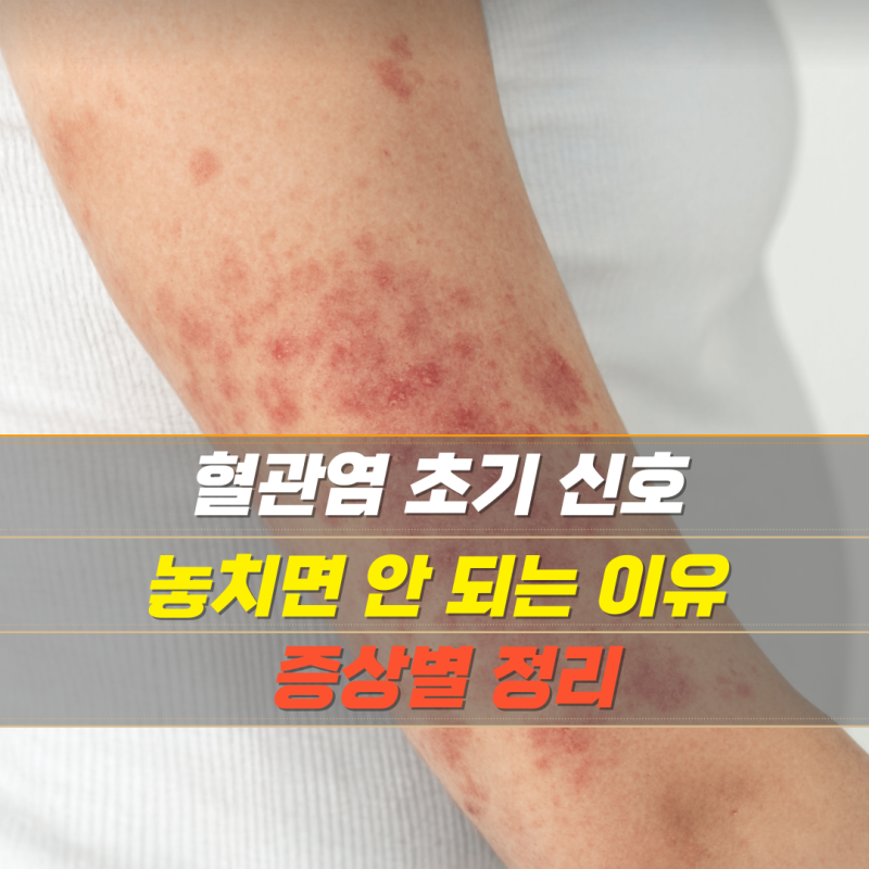 혈관염 초기 신호 놓치면 안 되는 이유, 증상별 정리