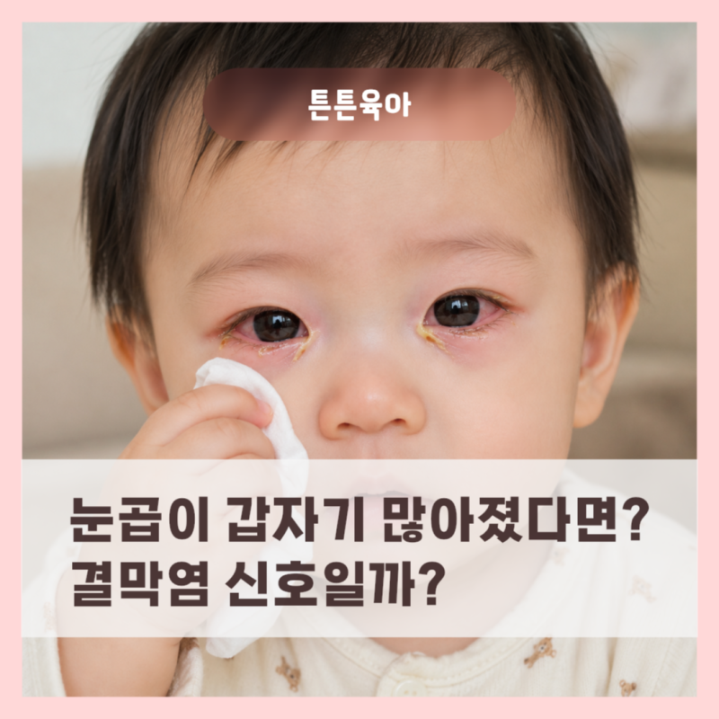 아기 눈곱이 갑자기 많아졌어요, 눈병 결막염 증상일까?