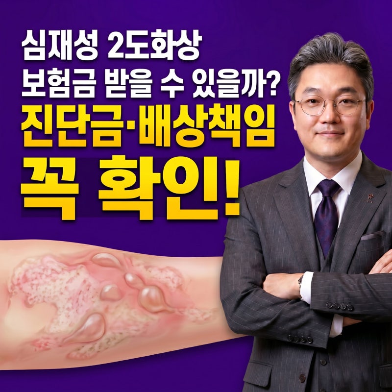 심재성 2도화상 보험금 받을 수 있을까? 진단금부터 배상책임까지 총정리