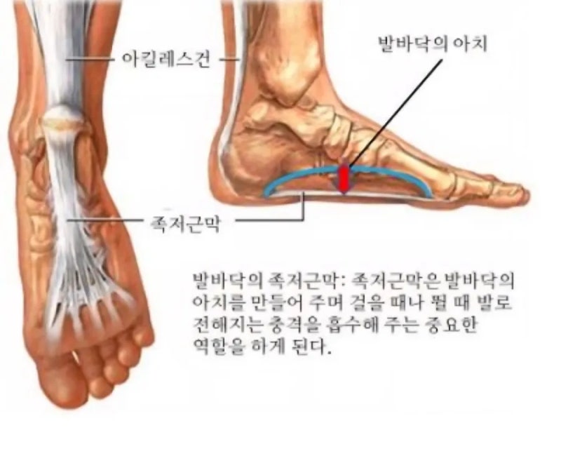왼쪽 발바닥 아치 통증 부위별 원인 한눈에 보기