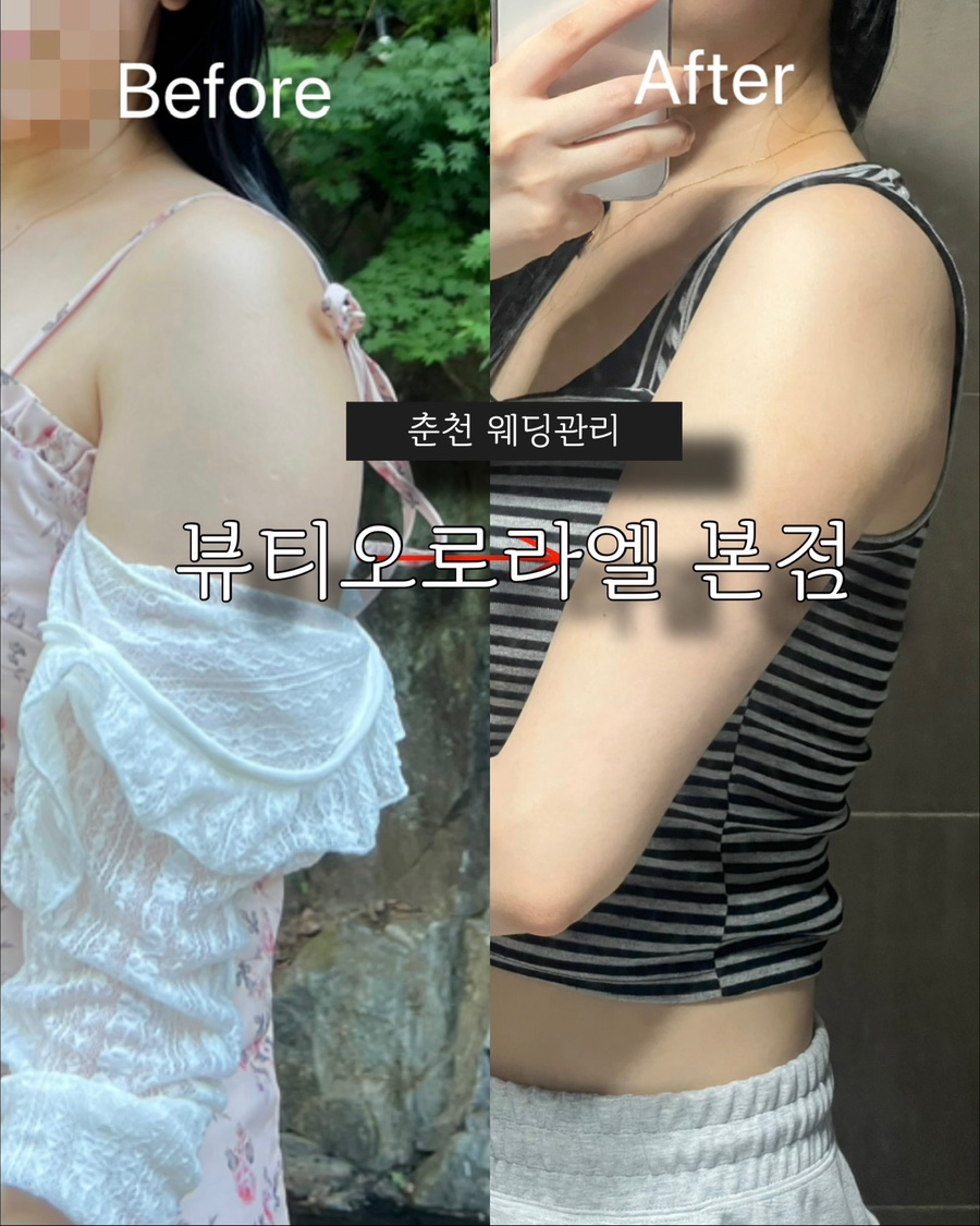 팔뚝갈비 본점 사진 1