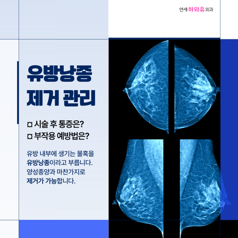 수서역 유방외과 유방 물혹 제거 시술 후 생길 수 있는 부작용과 통증 줄이는 방법 무엇인가....