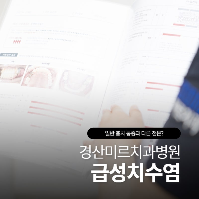 급성치수염 일반 충치 통증과 다른 점은?