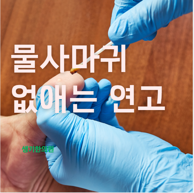 물사마귀 없애는 연고 사용 후에도 재발한다면