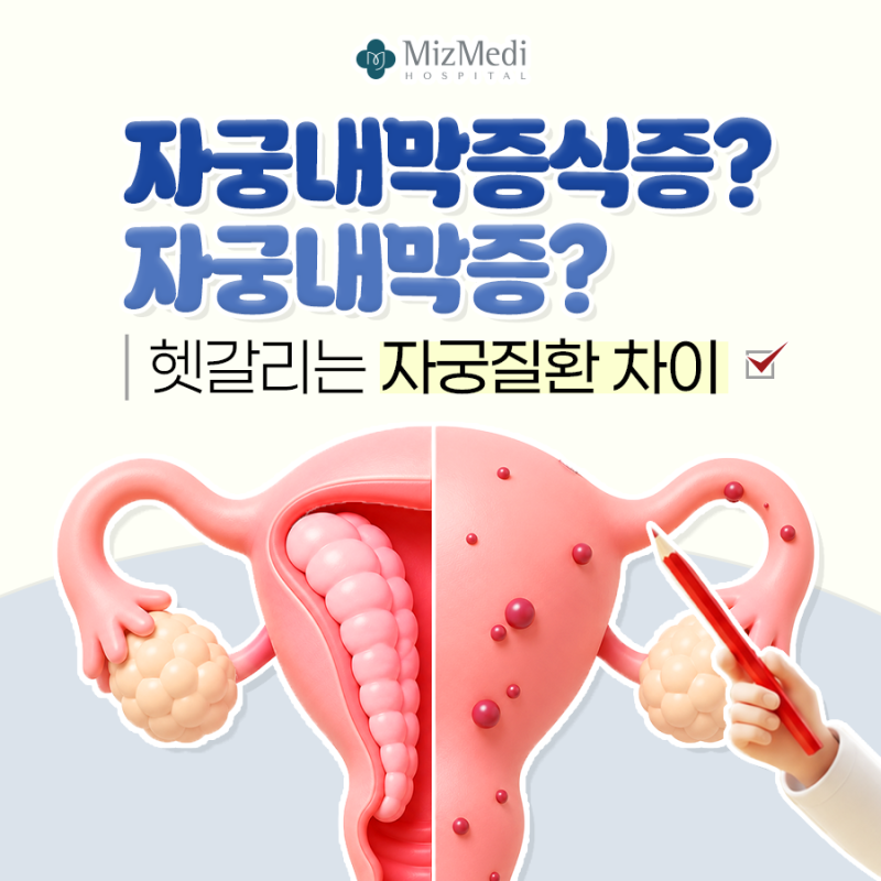 강서구 산부인과 자궁내막증식증? 자궁내막증? 헷갈리는 자궁질환 차이