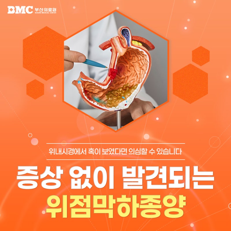 위점막하종양 , 모두 괜찮은 걸까? 주의해야 할 위장관기질종양(GIST) 복강경수술까지!