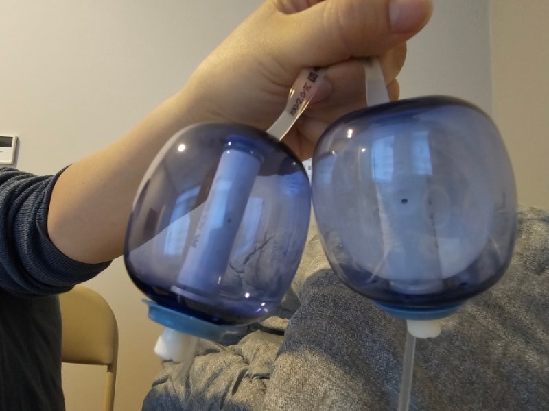 치질수술 4일차 후기, 생각보다 안 아팠던 배변 통증과 회복 과정