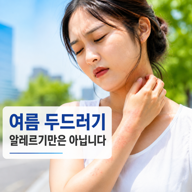 여름에 심해지는 두드러기 원인은 알레르기만이 아닙니다.* 땀, 열, 음식, 약물, 벌레물림까....
