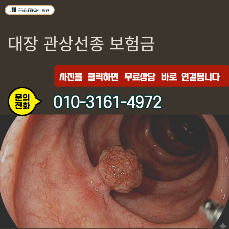 대장 관상선종 보험금, D01 vs D12 완전 정리