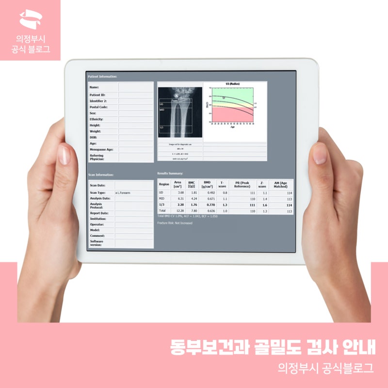뼈 건강 미리 챙기세요! 의정부시 보건소 골밀도 검사!
