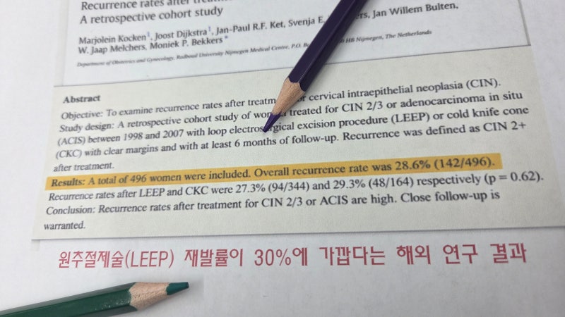 원추절제술 후 재발 방지를 위한 방법 안내