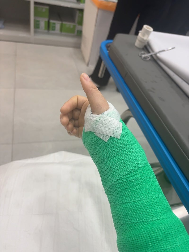 스키장에서 넘어져서 손목 분쇄 골절 수술한 후기 및 재활 후기