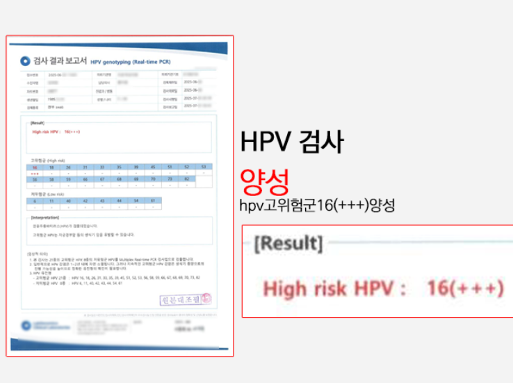 HPV 바이러스 16, 18, 33, 52 특히 조심해야 하는 이유