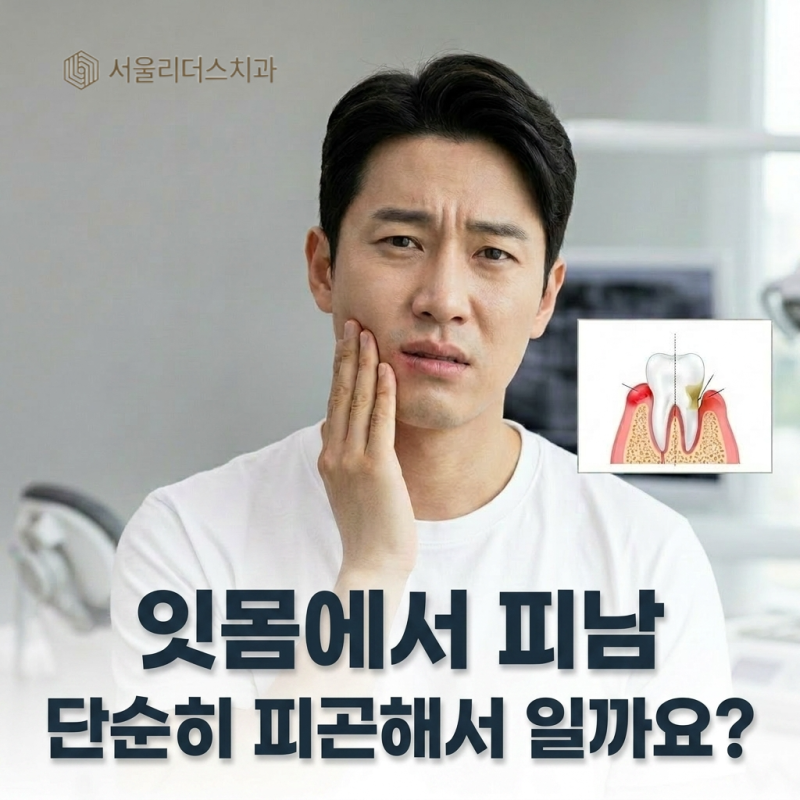 잇몸에서피남, 단순히 피곤해서일까요?