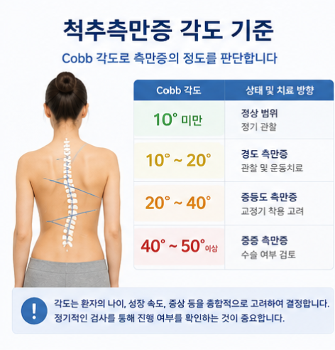 척추측만증 증상부터 치료방법까지, 교정이 필요한 신호 총정리