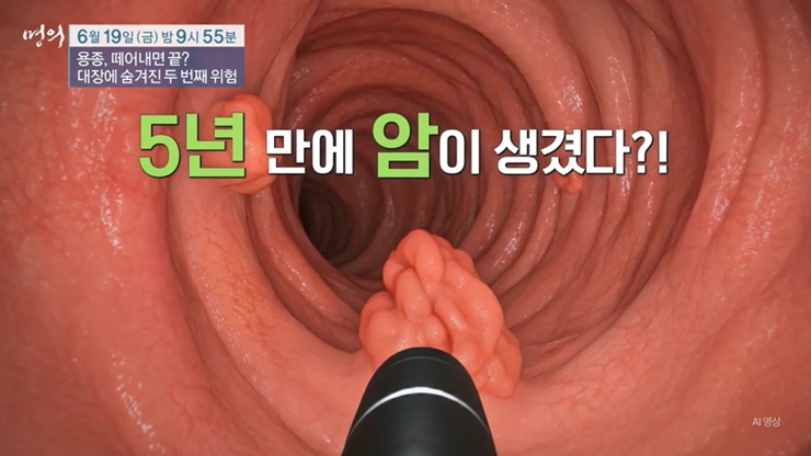 명의 대장항문외과 김형진 교수 <b>소화기내과 김진수 교수</b> 대장암... 